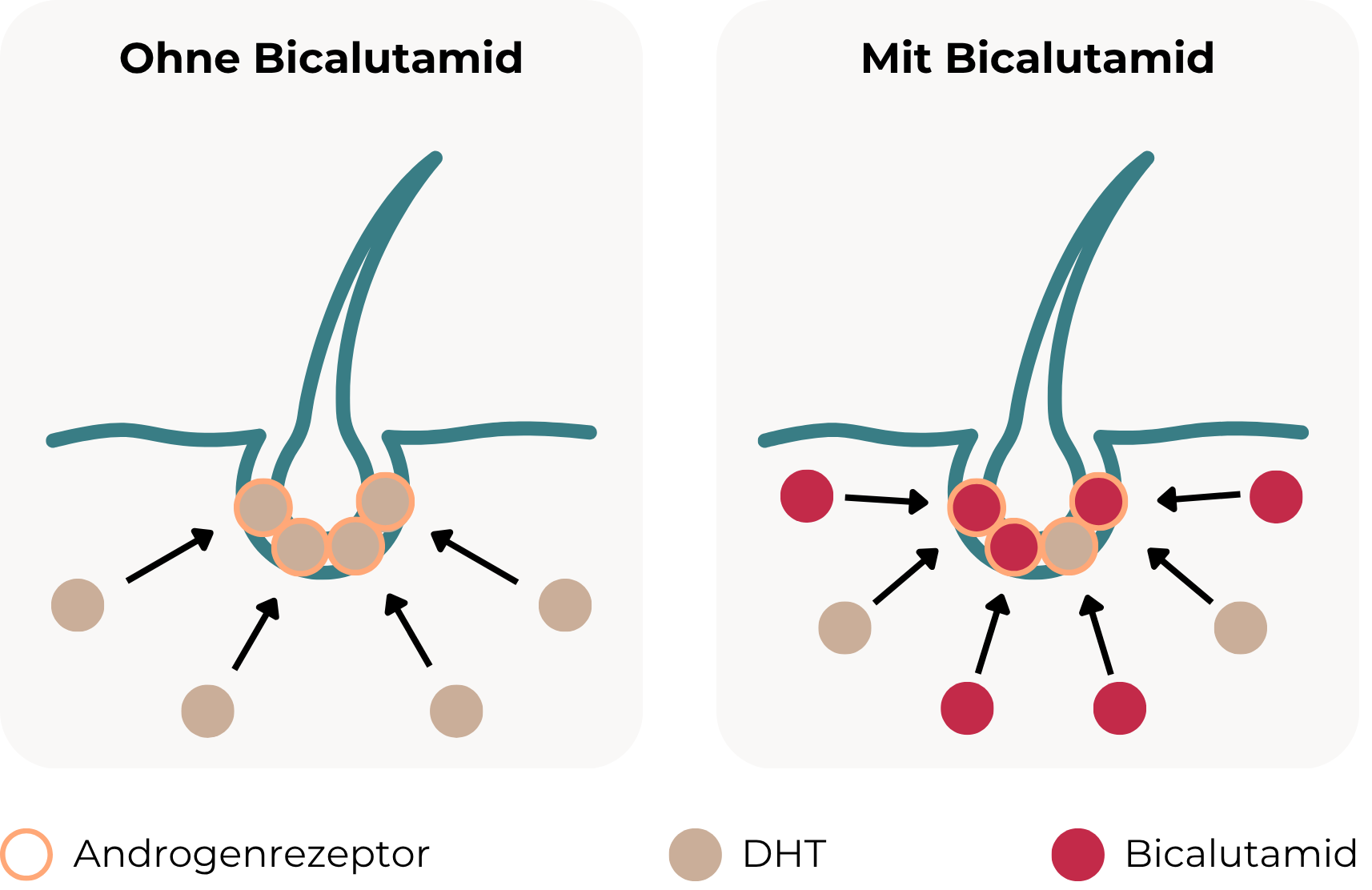 So bekämpft Bicalutamid Haarausfall: Die Grafik zeigt den Einfluss von Bicalutamid auf die Haarfollikel. Links: ohne Bicalutamid – DHT bindet an Androgenrezeptoren am Haarfollikel. Rechts: mit Bicalutamid – Bicalutamid blockiert die Androgenrezeptoren kompetitiv äußerst stark und reduziert so die Bindung von DHT.
