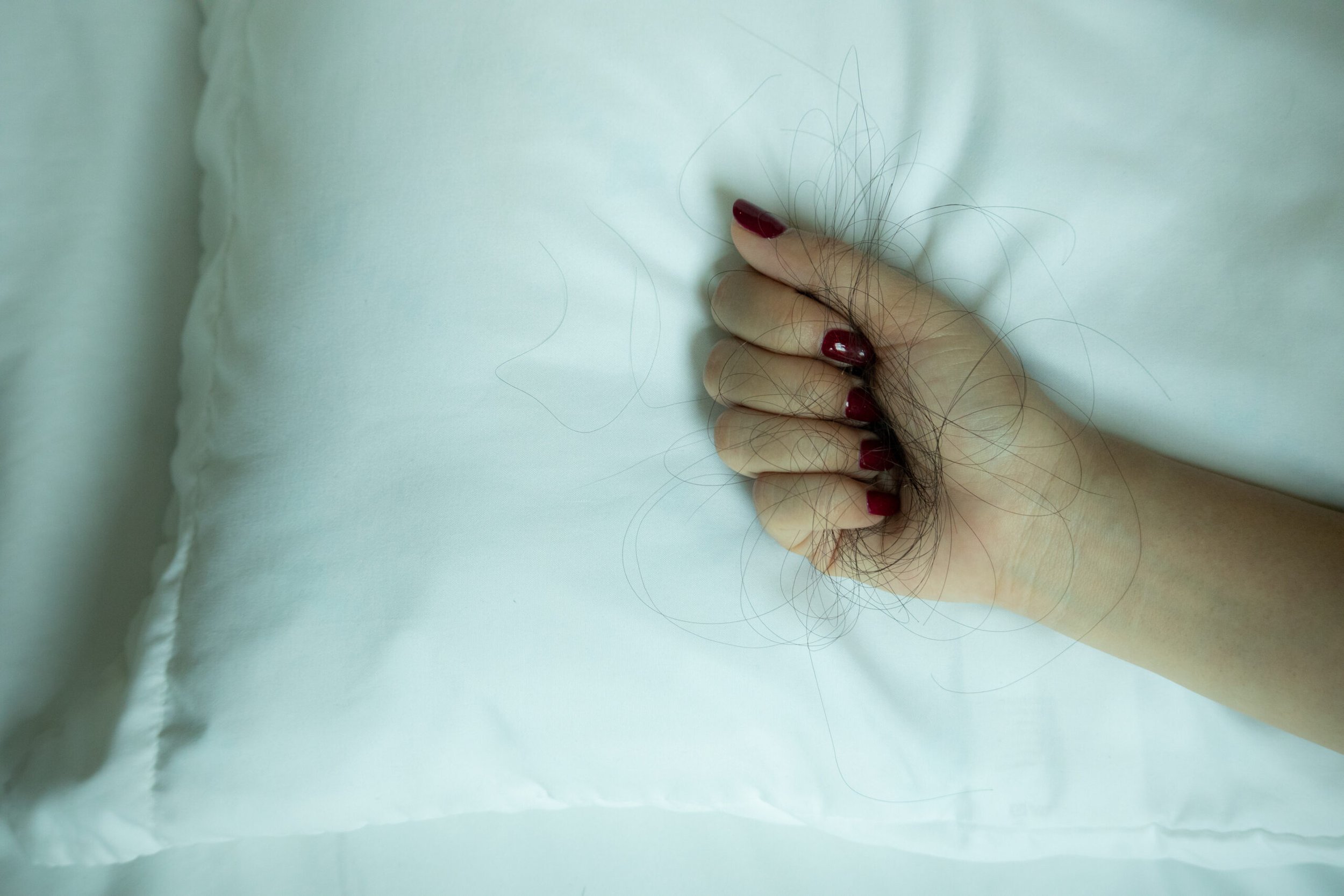 Hand einer Person mit roten Nägeln, die ausgefallene Haare hält, auf einem weißen Kissen liegend – diffuser Haarausfall macht sich oft genau so bemerkbar.