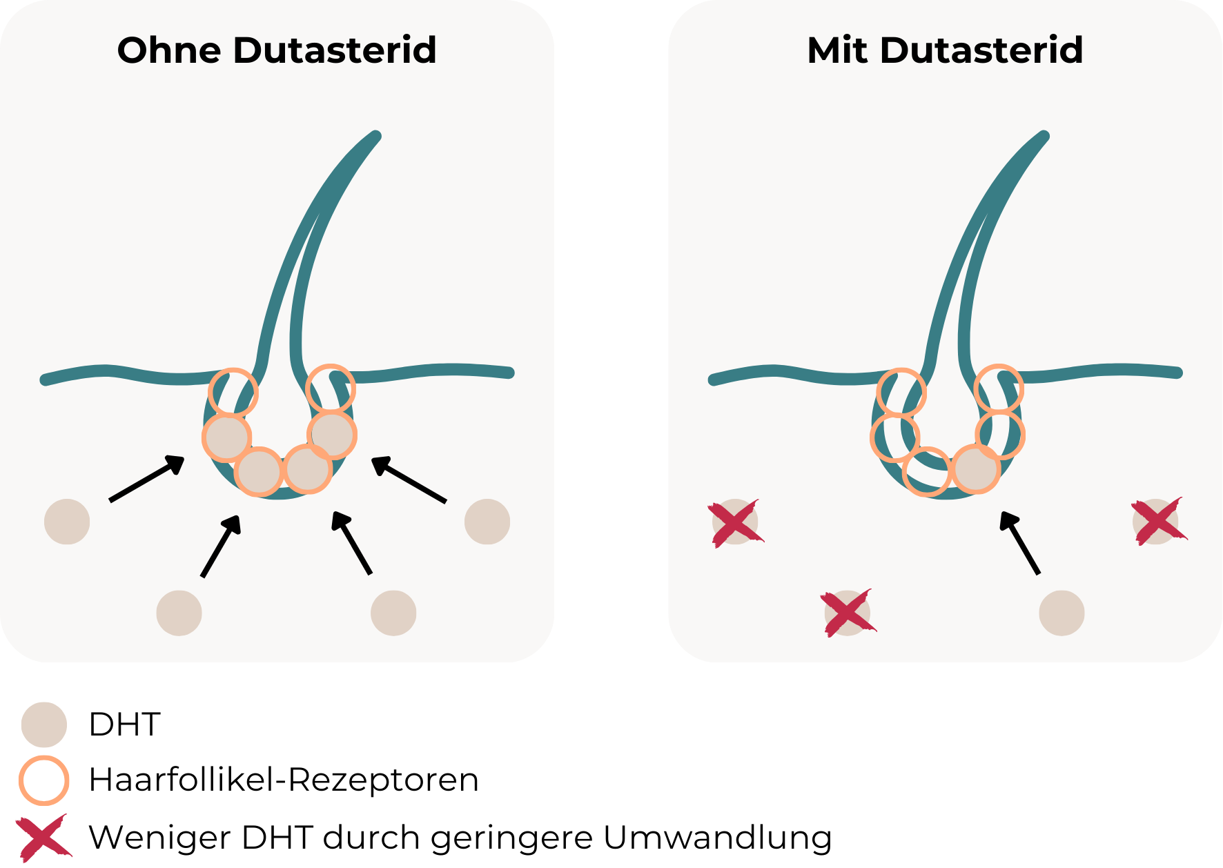 Die Grafik veranschaulicht die Wirkweise von Dutasterid anhand eines Vergleichs. Auf der linken Seite, mit der Überschrift "Ohne Dutasterid", wird dargestellt, wie DHT (Dihydrotestosteron) die Haarfollikel angreift. Die Androgenrezeptoren der Haarfollikel sind durch orangefarbene Ringe dargestellt, und mehrere beige Kreise außerhalb der Follikel symbolisieren DHT-Moleküle, die mit schwarzen Pfeilen auf die Rezeptoren der Follikel zeigen, um den Angriff zu verdeutlichen. Auf der rechten Seite, mit der Überschrift "Mit Dutasterid", wird gezeigt, dass Dutasterid die Bildung von DHT blockiert. Die meisten DHT-Moleküle (beige Kreise) sind durch rote Kreuze markiert, was auf ihr Fehlen hinweist. Die Haarfollikel bleiben dadurch geschützt, und nur ein kleiner Pfeil zeigt auf einen Rezeptor des Follikels, um den reduzierten Angriff zu verdeutlichen. Am unteren Rand der Grafik wird die Legende dargestellt: Ein beiger Kreis steht für DHT, ein oranger Ring symbolisiert die Rezeptoren der Haarfollikel, und ein rotes Kreuz zeigt die Abwesenheit von DHT an.
