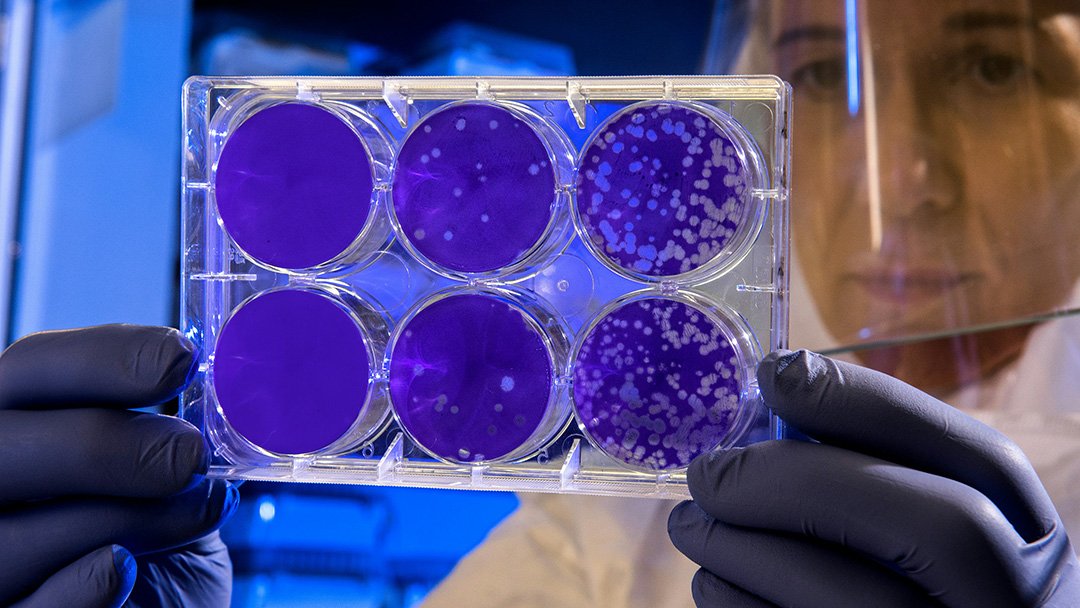 Wissenschaftlerin mit Schutzvisier hält eine Zellkulturplatte mit violetten Proben – symbolische Darstellung der Erforschung von Wirkstoffen wie PP405 gegen Haarausfall.