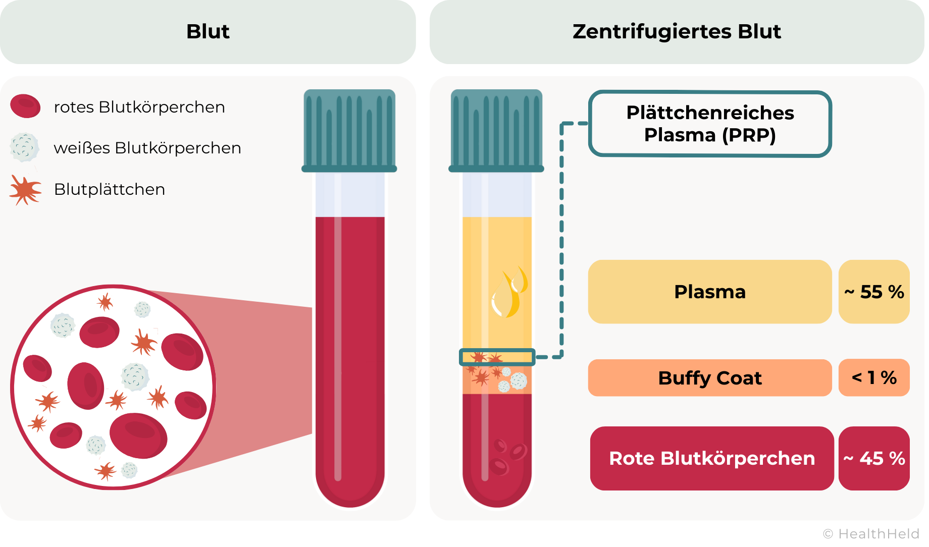 Die Grafik zeigt den Unterschied zwischen normalem Blut und zentrifugiertem Blut. Links ist ein Blutbehälter mit einer Mischung aus roten Blutkörperchen, weißen Blutkörperchen und Blutplättchen dargestellt. Rechts ist ein Behälter mit zentrifugiertem Blut abgebildet, das in drei Schichten getrennt ist: Plasma (~55 % oben, gelblich), Buffy Coat (<1 % in der Mitte, dünne Schicht mit Blutplättchen und weißen Blutkörperchen) und rote Blutkörperchen (~45 % unten, dunkelrot). Eine Markierung zeigt, dass plättchenreiches Plasma (PRP) aus der untersten Plasmaschicht gewonnen wird.