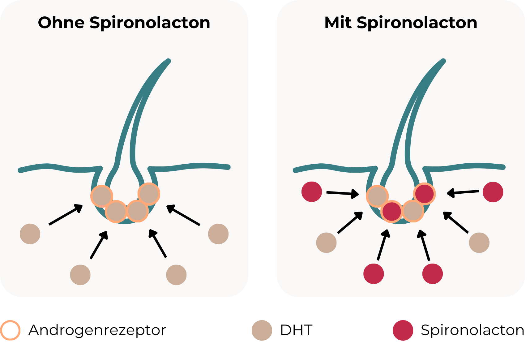 So bekämpft Spironolacton Haarausfall: Die Grafik zeigt den Einfluss von Spironolacton auf die Haarfollikel. Links: ohne Spironolacton – DHT bindet an Androgenrezeptoren am Haarfollikel. Rechts: mit Spironolacton – Spironolacton blockiert die Androgenrezeptoren kompetitiv und reduziert so die Bindung von DHT. Zudem ist mit Spironolacton grundsätzlich weniger DHT vorhanden, da Spironolacton die Androgenproduktion hemmt.