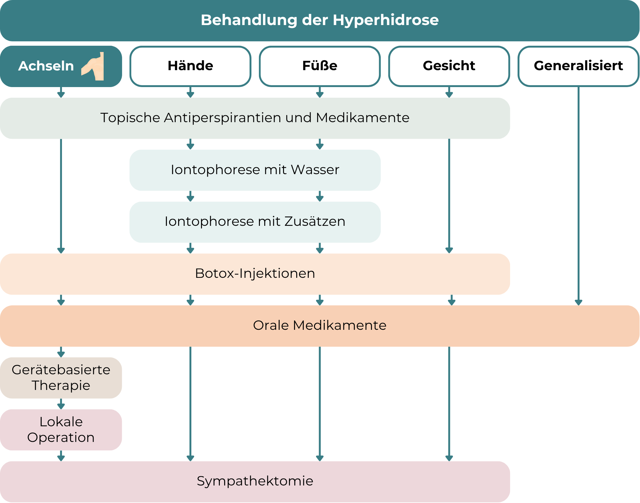 Starkes Schwitzen und den Achseln Behandlung: Die Grafik zeigt verschiedene Behandlungsoptionen für Hyperhidrose je nach betroffener Körperregion – Achseln, Hände, Füße, Gesicht und generalisiert (am ganzen Körper). Die Achseln sind besonders hervorgehoben. Die erste Maßnahme sind topische Antiperspirantien und Medikamente. Für Hände und Füße folgt eine stufenweise Iontophorese, zunächst mit Wasser, dann mit Zusätzen. In weiteren Schritten können Botox-Injektionen, orale Medikamente, gerätebasierte Therapien oder lokale Operationen angewendet werden. In schweren Fällen ist eine Sympathektomie – ein chirurgischer Eingriff – möglich. Der Verlauf ist als Entscheidungsbaum mit verschiedenen Therapieebenen dargestellt.