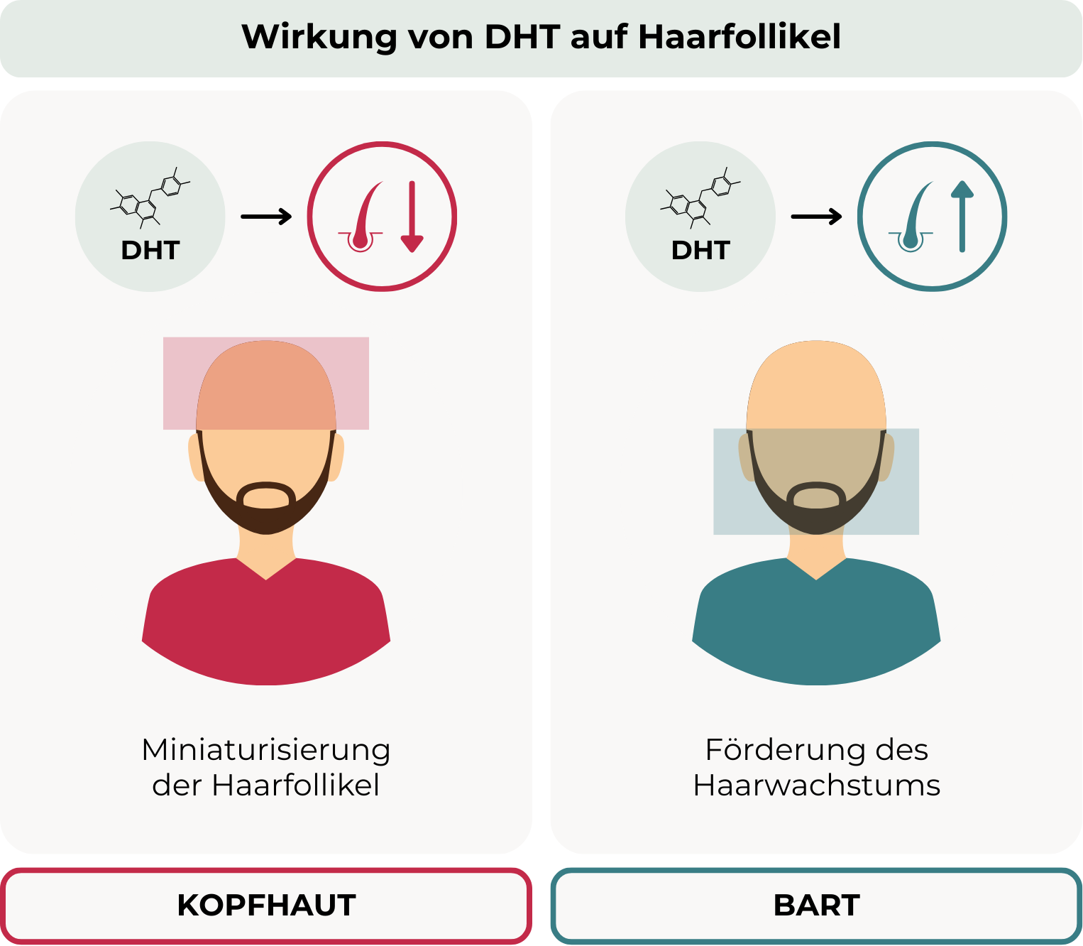 Darstellung der entgegengesetzten Wirkung von DHT auf Haarfollikel der Kopfhaut und des Bartbereichs. Links: DHT verursacht Miniaturisierung der Haarfollikel auf der Kopfhaut. Rechts: DHT fördert das Bartwachstum. Illustriert durch zwei Figuren mit unterschiedlichem Haarwuchs und Symbolen für Haarverlust bzw. Haarzunahme.