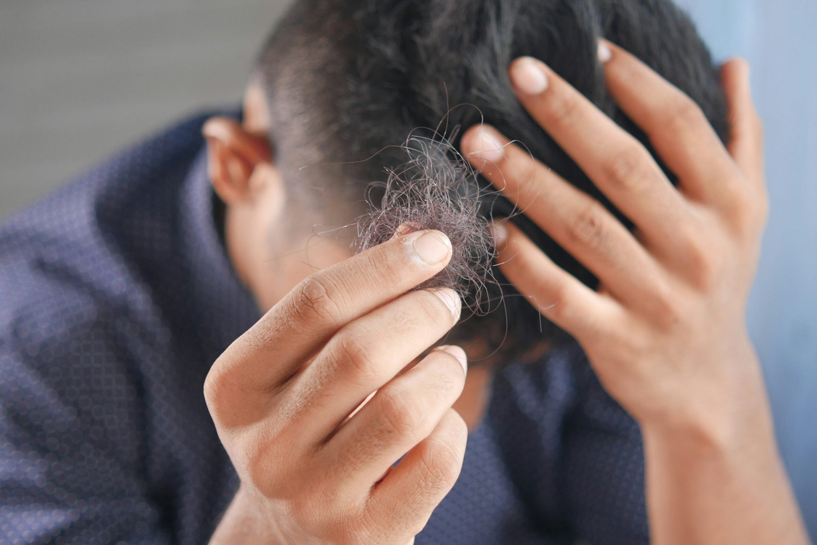 Mann mit Haaren in den Händen, bei welchem Zucker gegen Haarausfall helfen könnte.