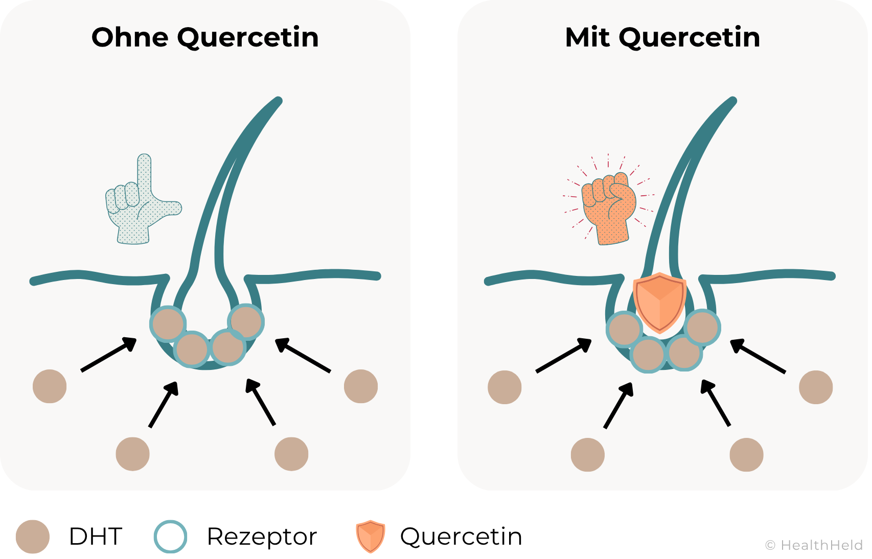 Zwiebelsaft Haare - Die Grafik zeigt eine Gegenüberstellung von einem Haarfollikel ohne Einfluss von Quercetin und einem mit Einfluss von Quercetin. Ohne Quercetin dockt DHT an den Rezeptoren des Haarfollikels an und der Haarfollikel erlebt eine Miniaturisierung (eine Hand zeigt ein L für Verlierer). Mit Quercetin greift DHT ebenso den Haarfollikel an, aber das Quercetin wirkt wie ein Schutzschild. Eine geballte Hand daneben zeigt die Überlebensbereitschaft des Haarfollikels.